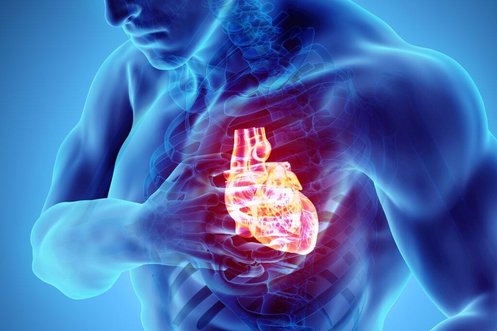 cardiogenic shock causes