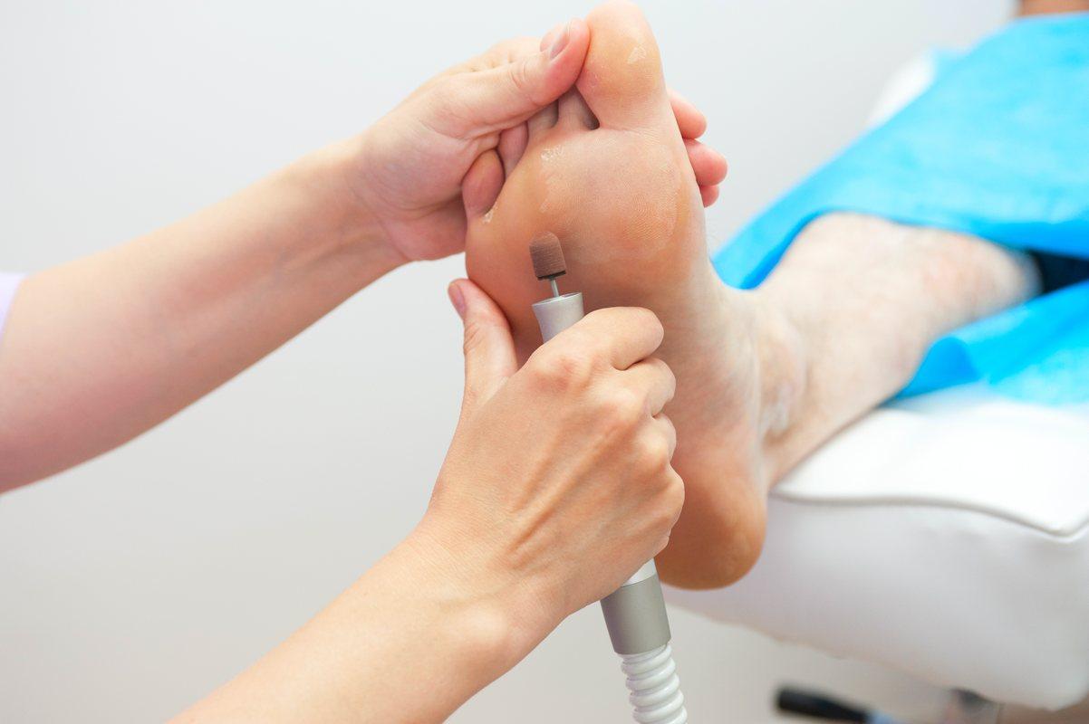 Difference between Podiatrist & Chiropodist