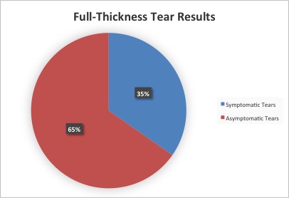 Full-thickness tear