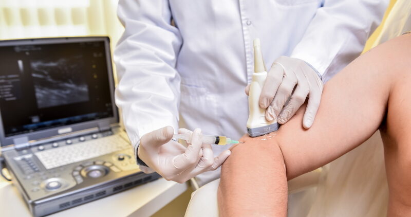 PRP injection treatment