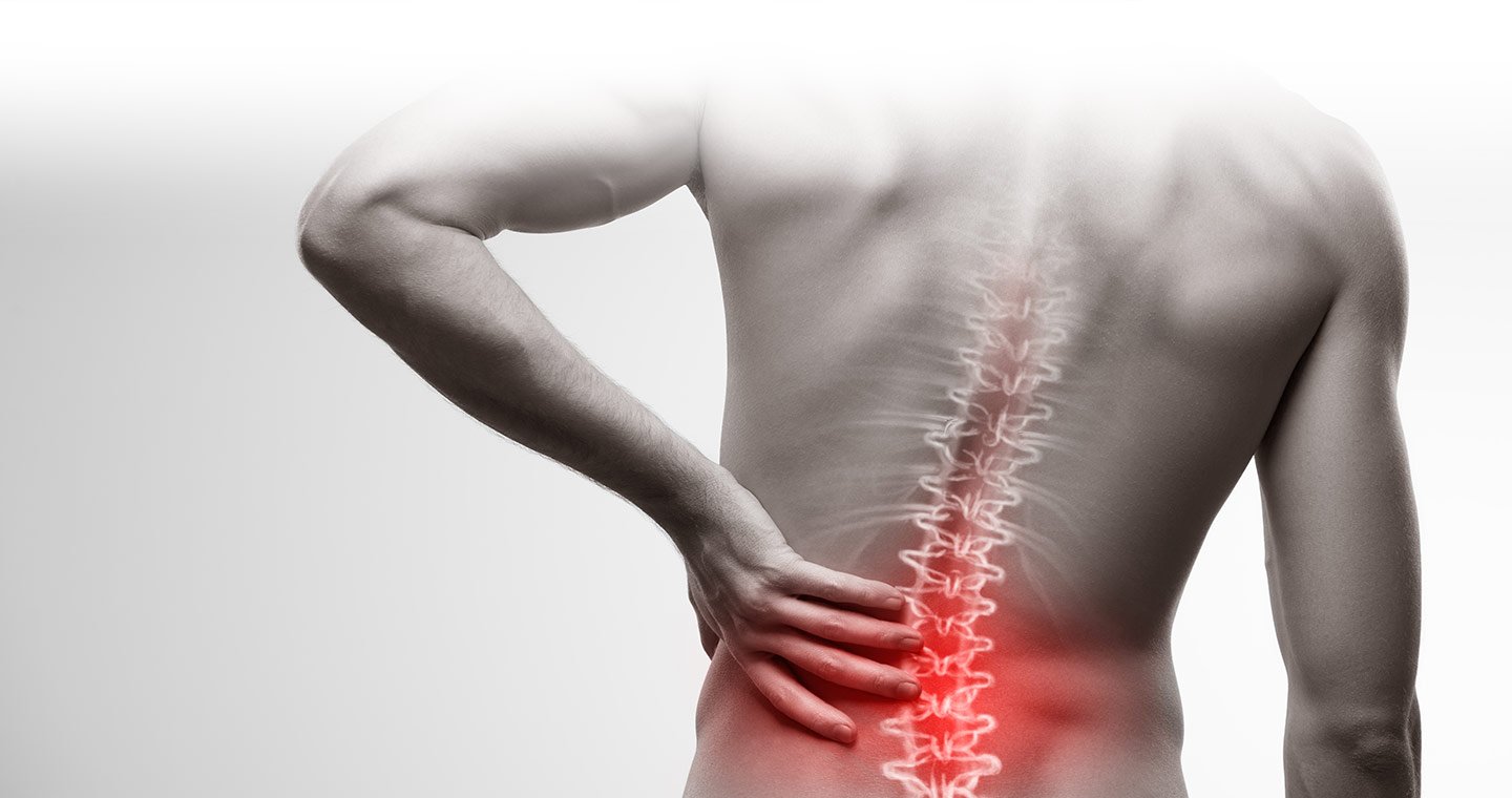 Exercises to Relieve Severe Back Pain
