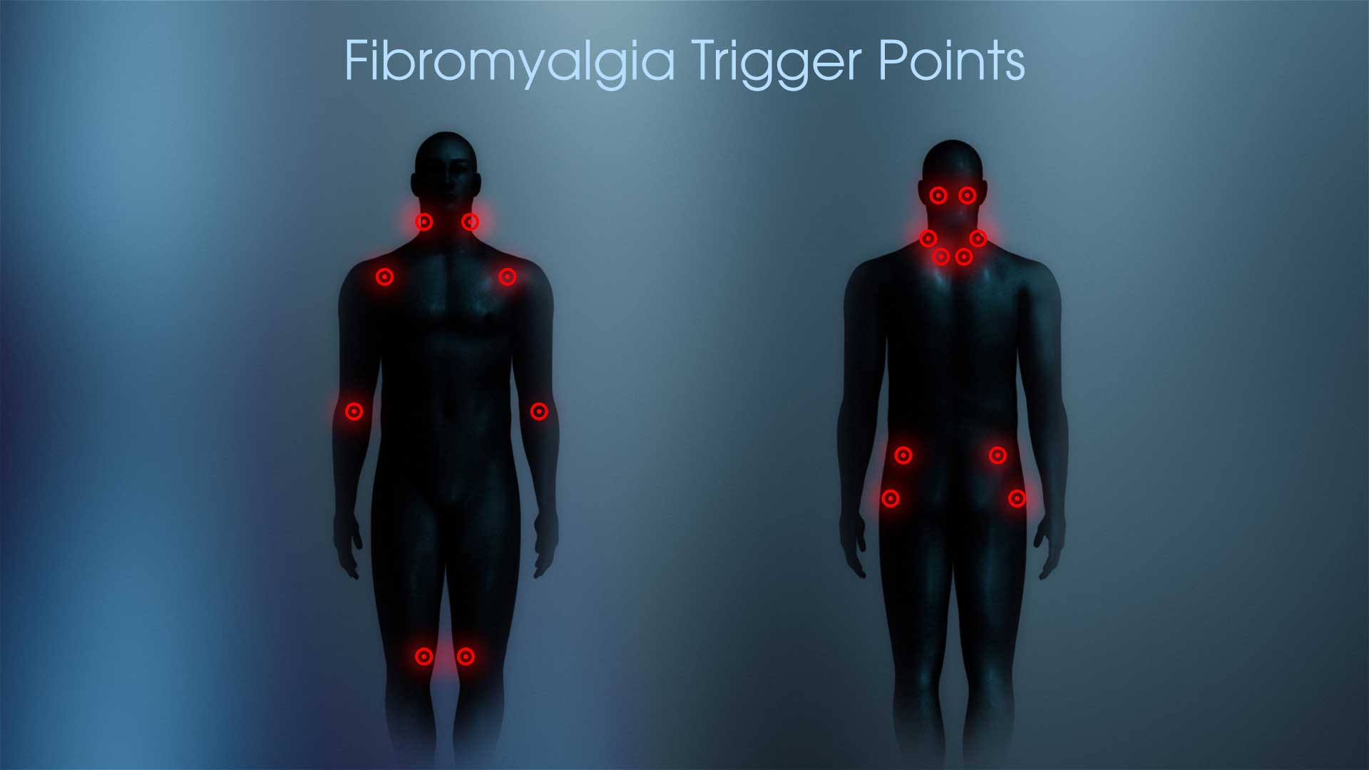 Fibromyalgia: Causes, Symptoms, and Treatment Options