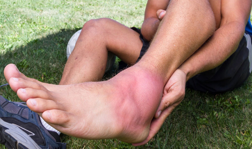 TREATMENT OF FOOT AND ANKLE TENDONITIS