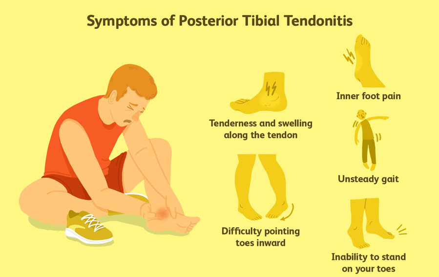 Symptoms of Foot and Ankle Tendonitis