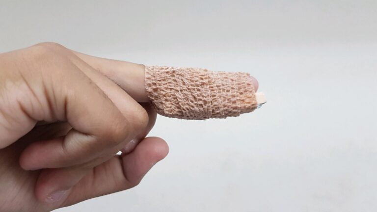Diagnose of Mallet Finger