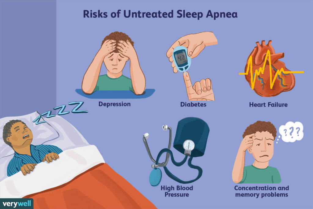 Show Risk of Sleep Apnea