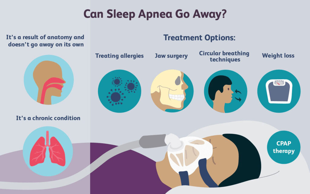 Sleep Apnea Treatment