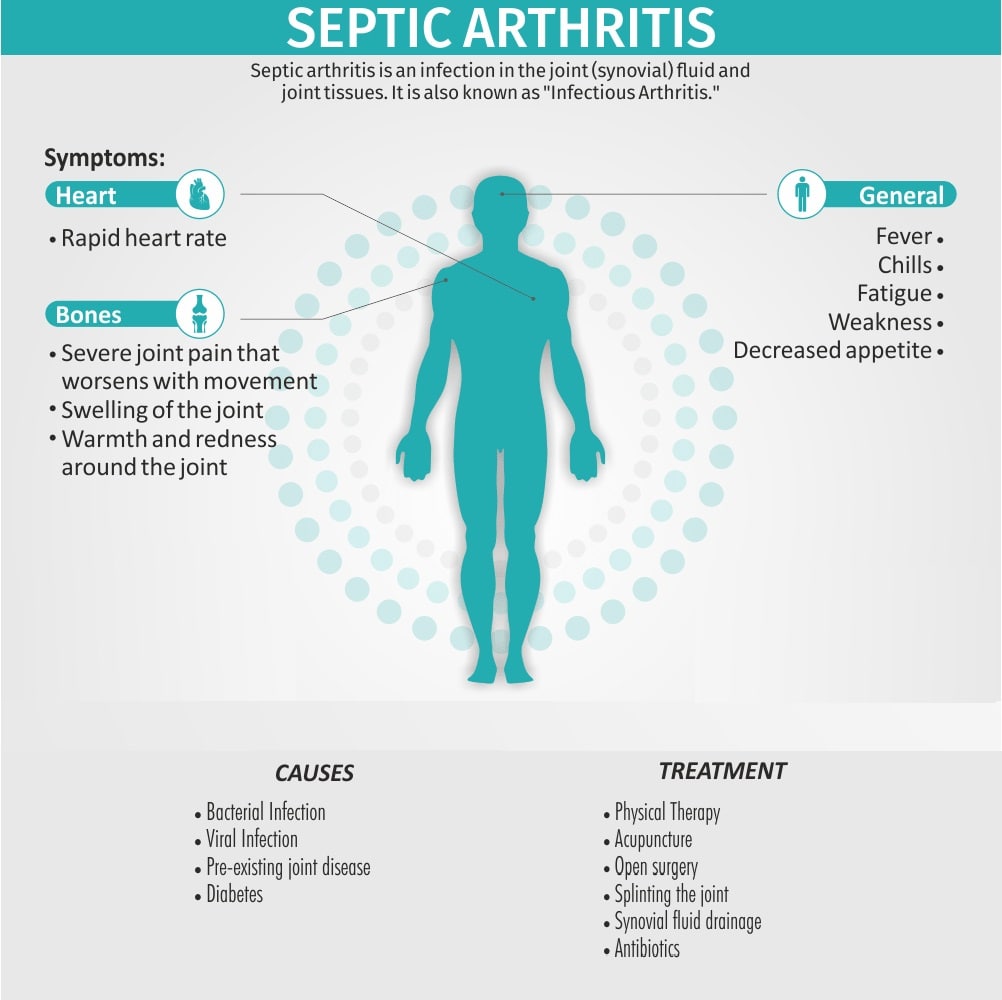 What is Septic Arthritis?