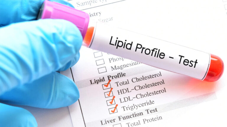 Diagnosis of Hyperlipidemia