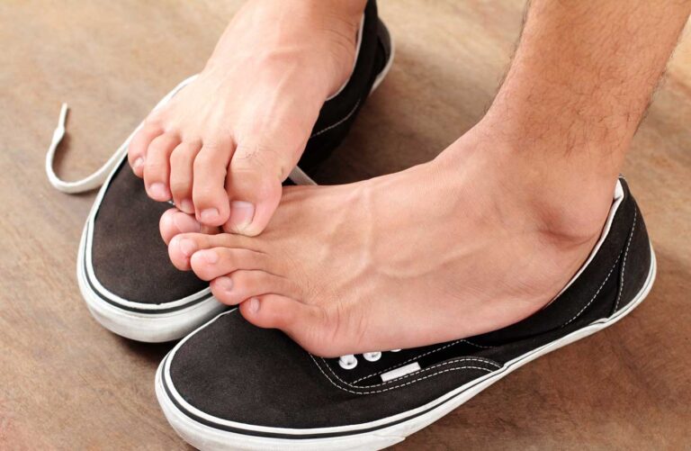 Treatment for Athlete's foot