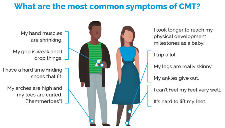 Charcot Marie Tooth Disease Symptoms