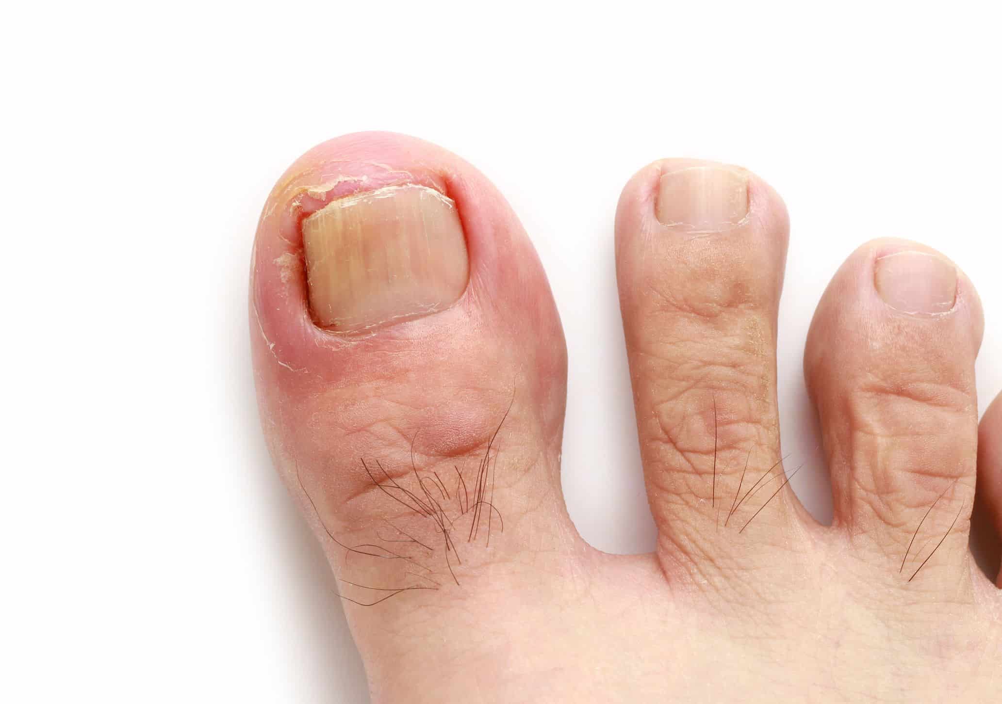 Medical Conditions That Can Affect Your Feet