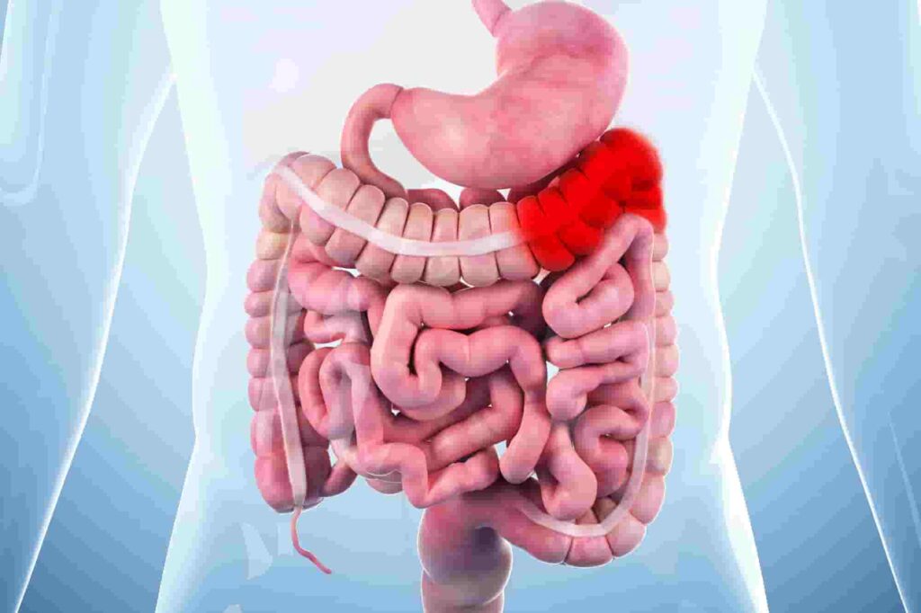 Stages of Lung Cancer