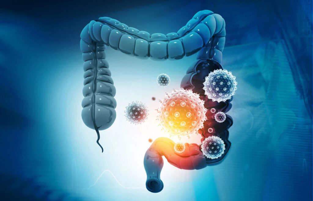 Gut Microbiota Composition