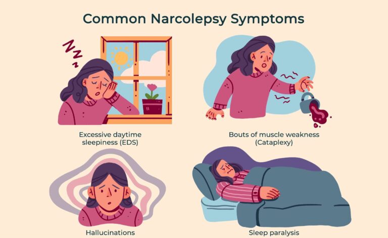 Common Narcolepsy Symptoms