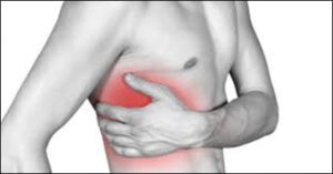 Rib Pain: Causes, Symptoms, and Treatment Options