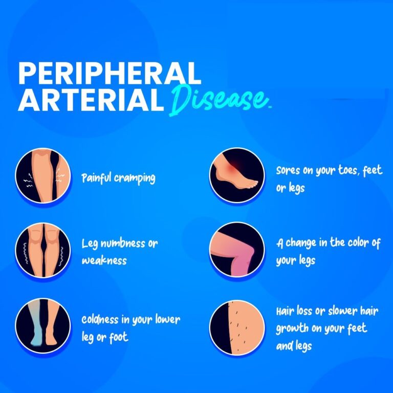 Peripheral Arterial Disease