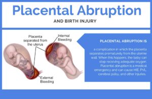 What is Placental Abruption?