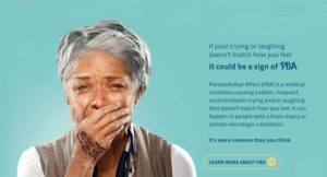 Pseudobulbar Affect: Symptoms, Causes & Treatment