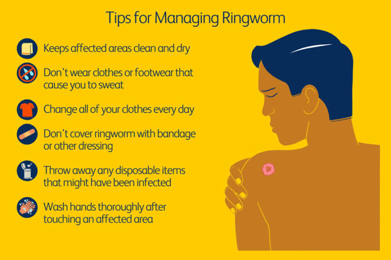 Ringworm Prevention