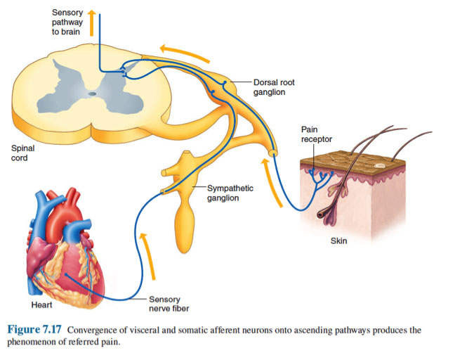 Myofascial pain