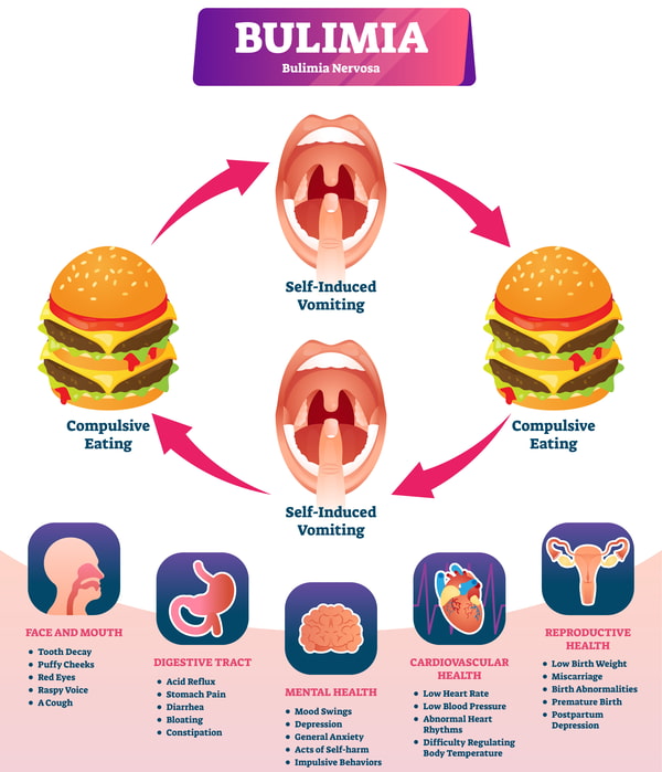 SYMPTOMS OF BULIMIA NERVOSA