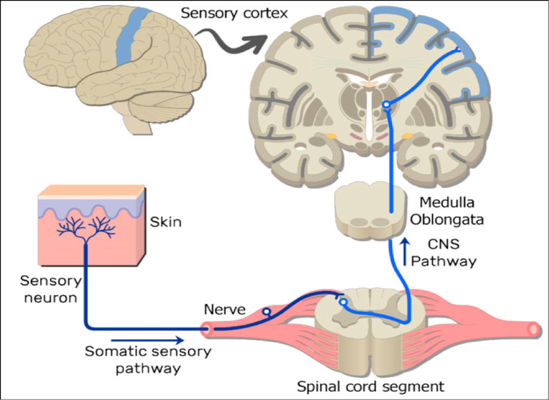 what is somatic pain?