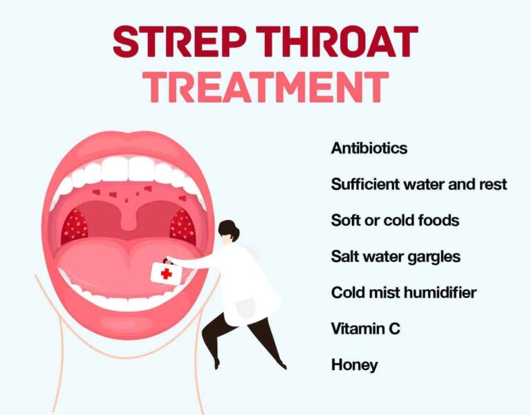 Strep Throat Treatment