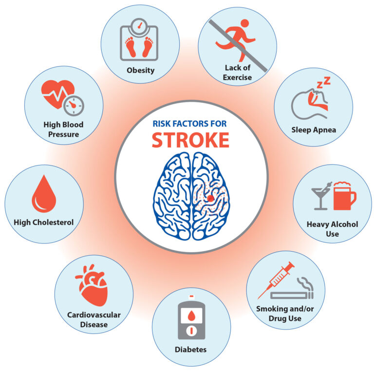 Risk Factors Of Stroke