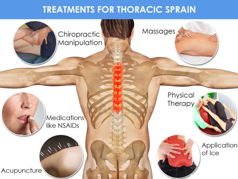 Treatment for Thoracic Sprain