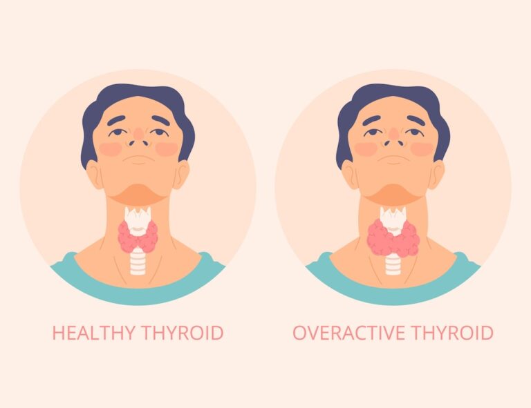 Thyroid level