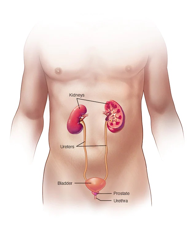 Ureteral Obstruction