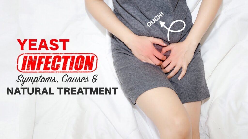 Vaginal Yeast Infection Treatment