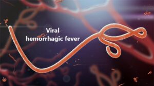 What is Viral Hemorrhagic Fevers?