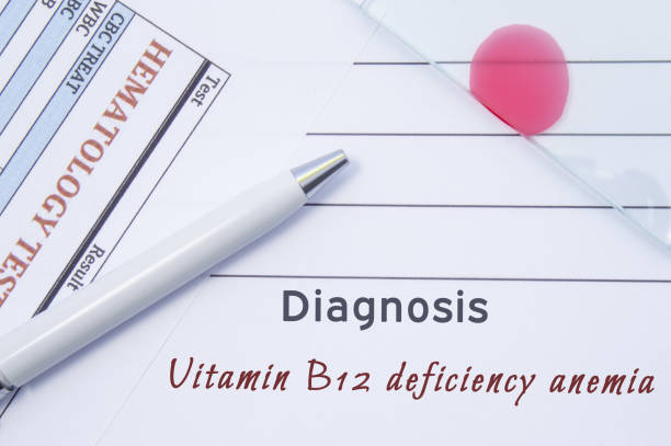 Vitamin Deficiency Anemia Diagnosis