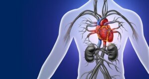 Aortic Dissection - Symptoms, Causes, and Treatment