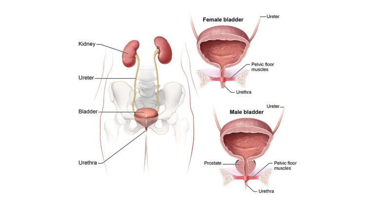 Bladder Pain