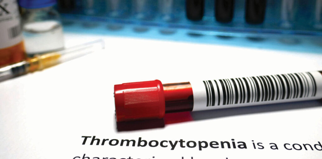 Thrombocytopenia Treatment