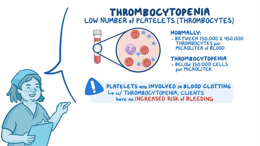 What is Thrombocytopenia?