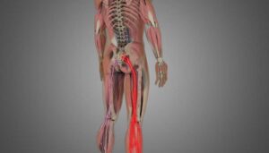 Lumbar Radiculopathy (Sciatica)