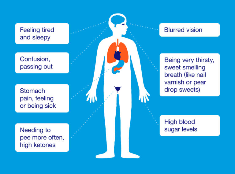 Diabetic Ketoacidosis Symptoms