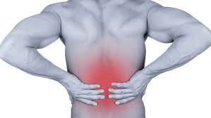 Back Pain Radiculopathy