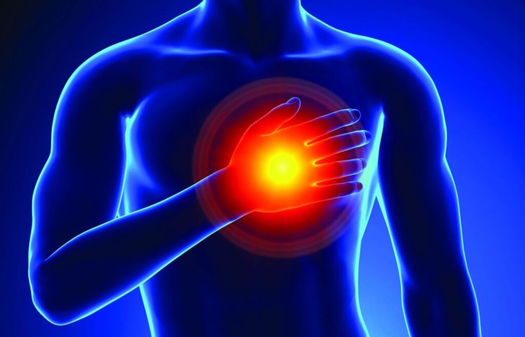 Myocardial ischemia