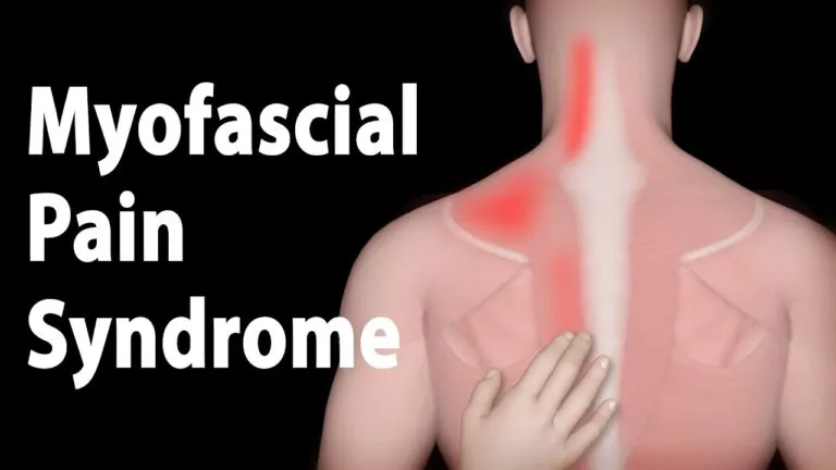 Myofascial Pain Syndrome Symptoms 