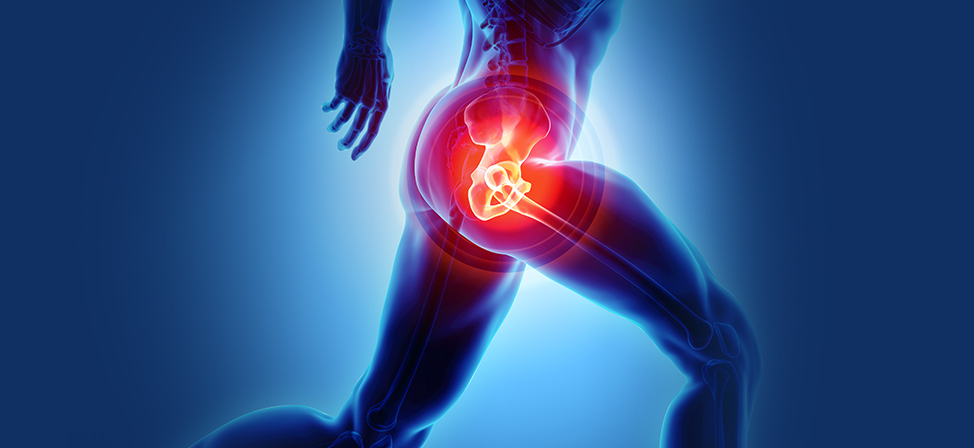 SI joint pain diagnosis