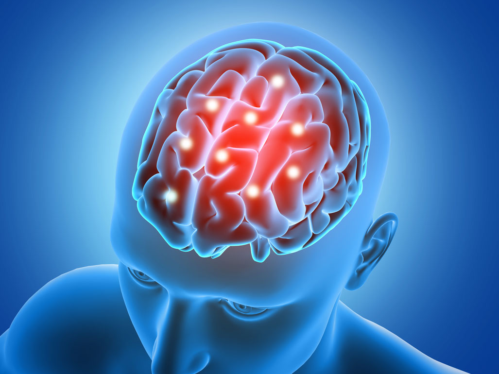 Brain Tumour Myths Debunked 