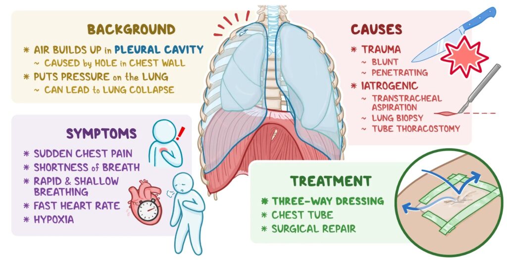 Asbestosis