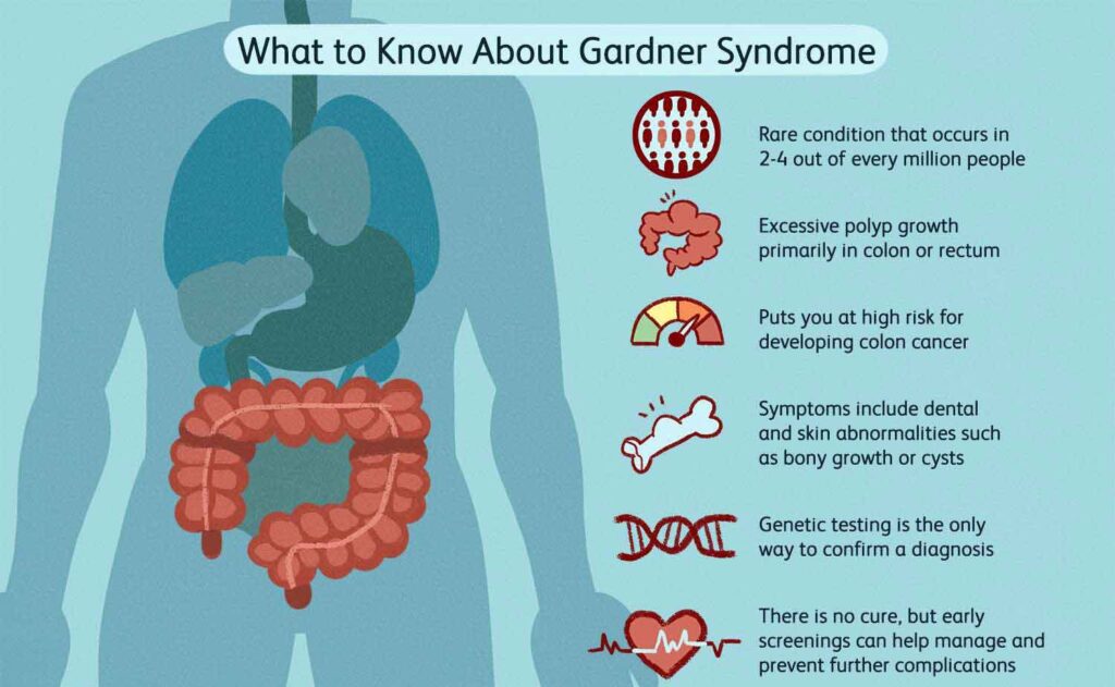 What is Gardner's Syndrome?