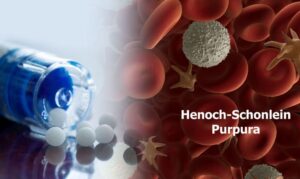 Henoch-Schonlein Purpura