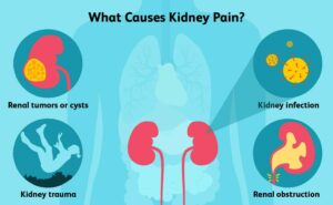 What are the Causes of Kidney Pain?